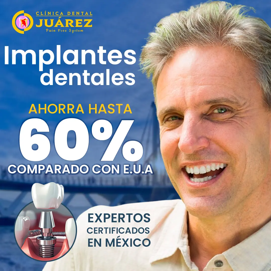 Dental Implants in Puerto Vallarta