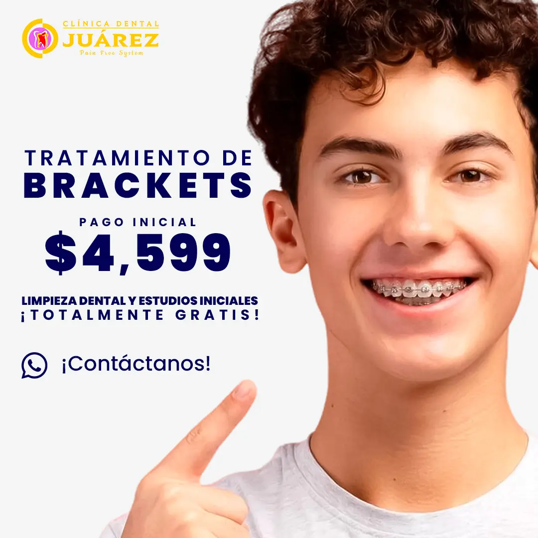 Promo orthodontics